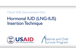 Hormonal IUD (LNG-IUS) Insertion Technique