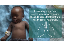 Pneumonia Education - Video: Chest In-Drawing