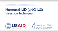 Hormonal IUD (LNG-IUS) Insertion Technique