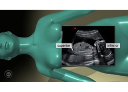 How to use the ultrasound probe